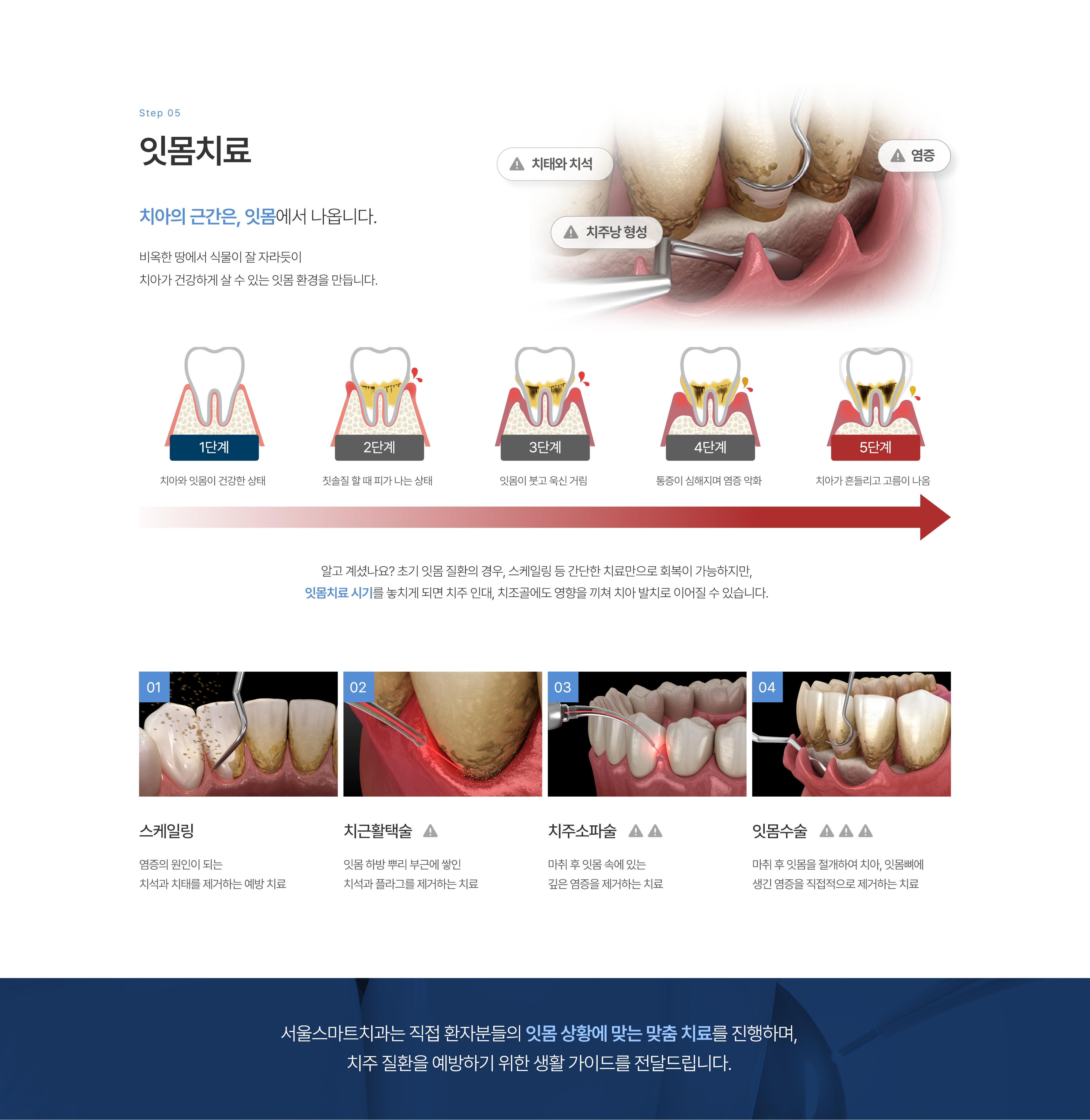 잇몸치료